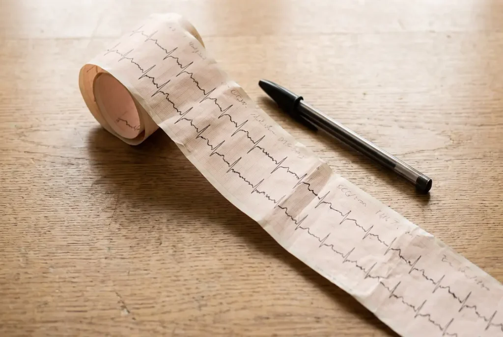 ECG printout with a pen on a wooden desk