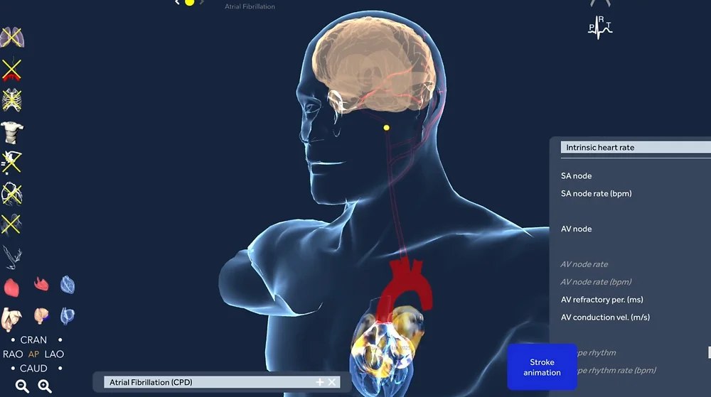 Why The Offbeat Community Could Change Atrial Fibrillation Research