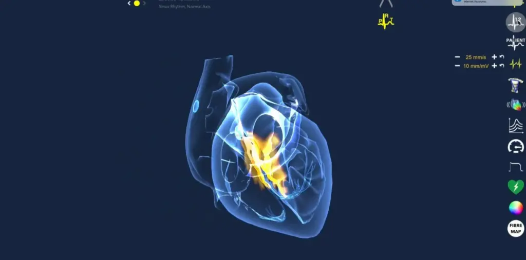 3D illustration of the heart's electrical conduction system